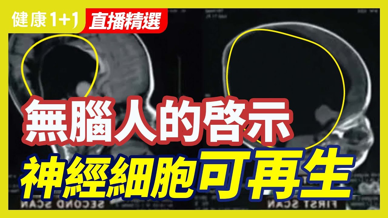 [ID: ura5265wyVM] Youtube Automatic